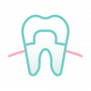 Реставрация зубов - Стоматологическая клиника АВЕРОН