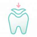 Лечение зубов - Стоматологическая клиника АВЕРОН